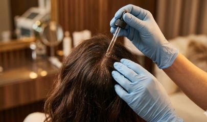 Hair Fall & Dandruff